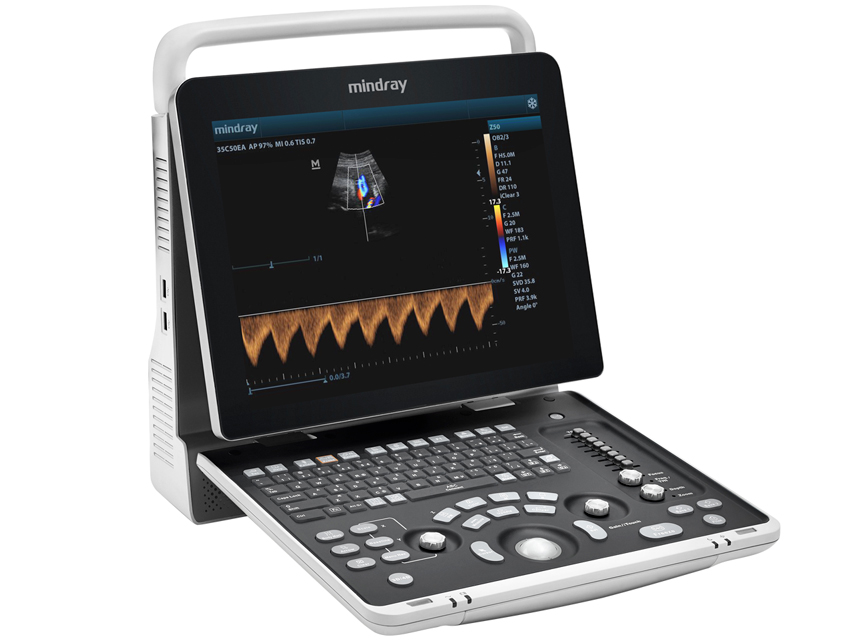 Ultrasonogrāfijas ierīces, MINDRAY Z50 ultrasonogrāfs ar 2 zondēm