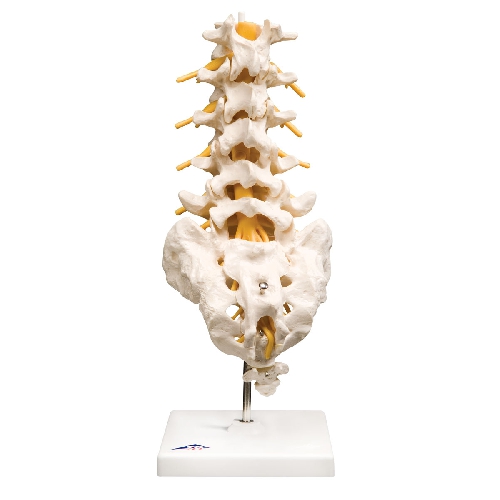 Muguras jostas daļas kanāls ar noslīdējušu sānu skriemeļa disku, Lumbar Section