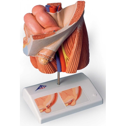 Ceļa modelis, Inguinal Hernia modelis