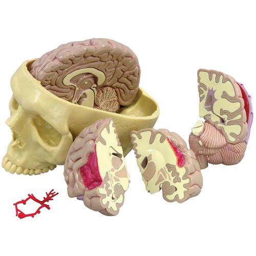 SMADZEŅU MODEĻI, Brain Model 1