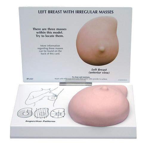 BREAST MODELS, Left Breast Model with Irregular Masses