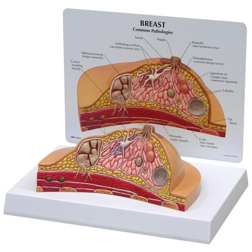 BREAST MODELS, Breast Cross-Section Model