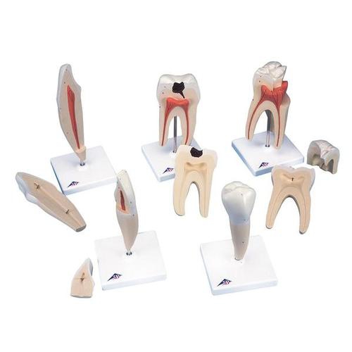 Dental model, Classic Tooth Model Series, 5 models