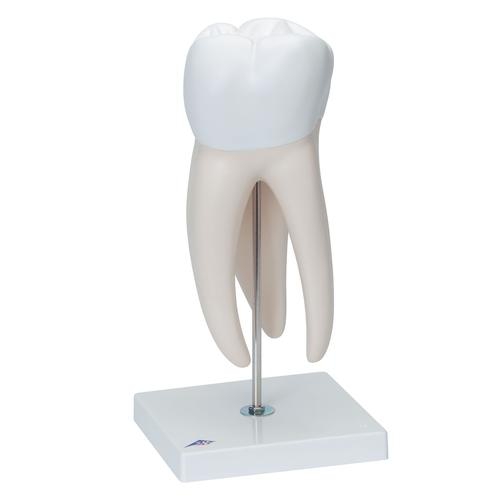 016Giant Molar with Dental Cavities, 15 times life size, 5 part