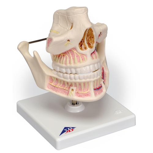 Dental model, Adult Dentures