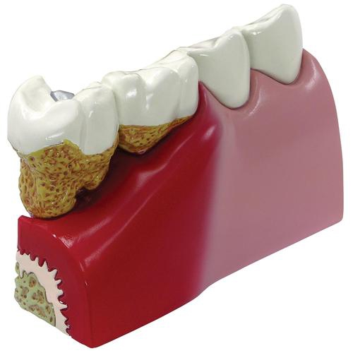Dental model, Teeth Model 1