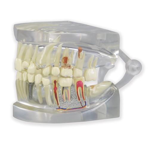Dental model, Clear Human Jaw with teeth model