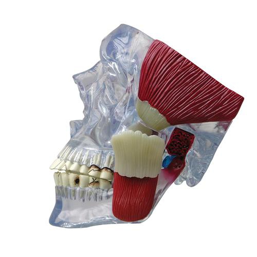Dental model, TMJ Model