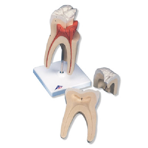 Dental model, Upper Triple-Root Molar, 3 part