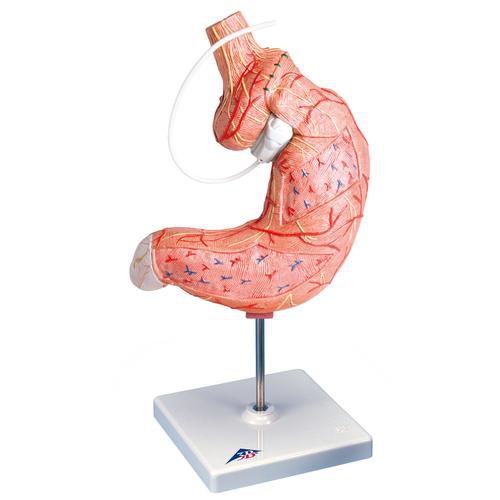 009Gastric Band Model