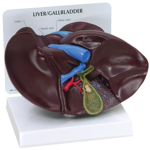 DIGESTIVE SYSTEM MODELS, Liver/Gallbladder Model with Gallstones