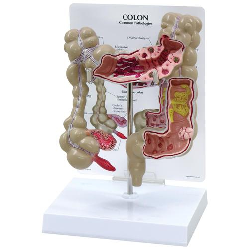 017Colon Model