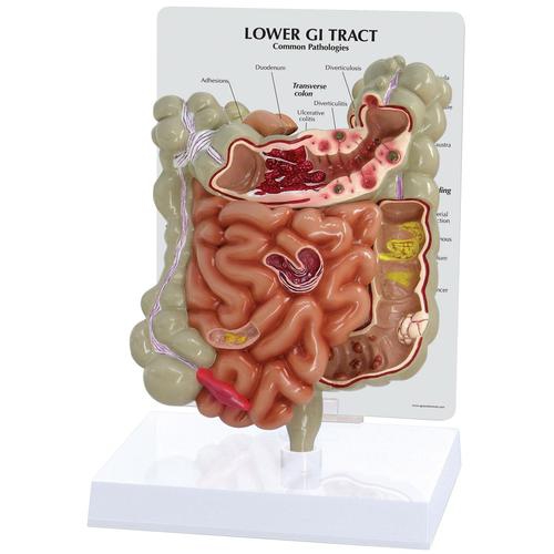 DIGESTIVE SYSTEM MODELS, GI Tract Model