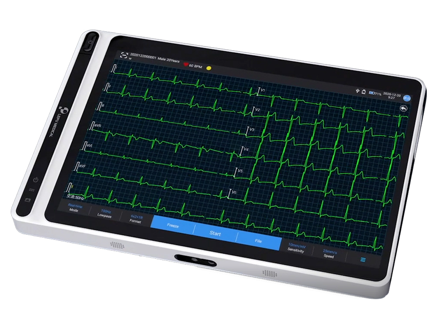 NEO ECG S120 TABLET ECG - SNAP PLUG