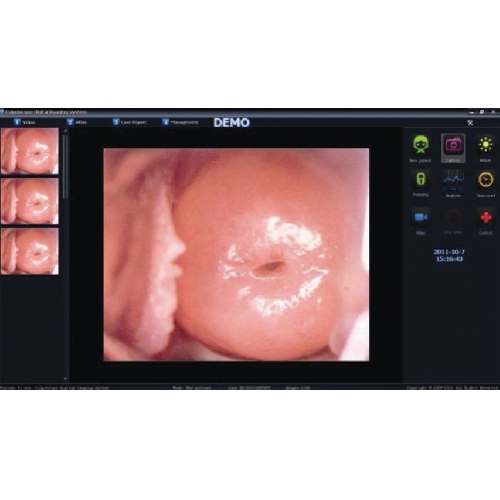 COLPOSCOPY SOFTWARE FOR 29624. 29625